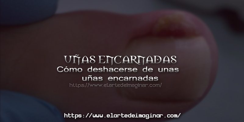 Las uñas encarnadas se clasifican en tres categorías.
